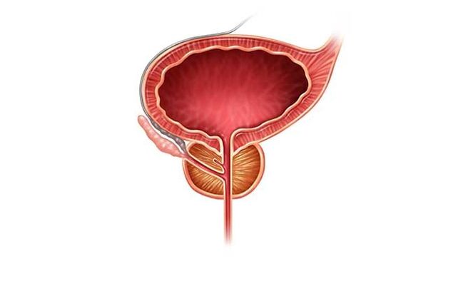 zdrave prostate po zdravljenju s kapsulami Predstonorm